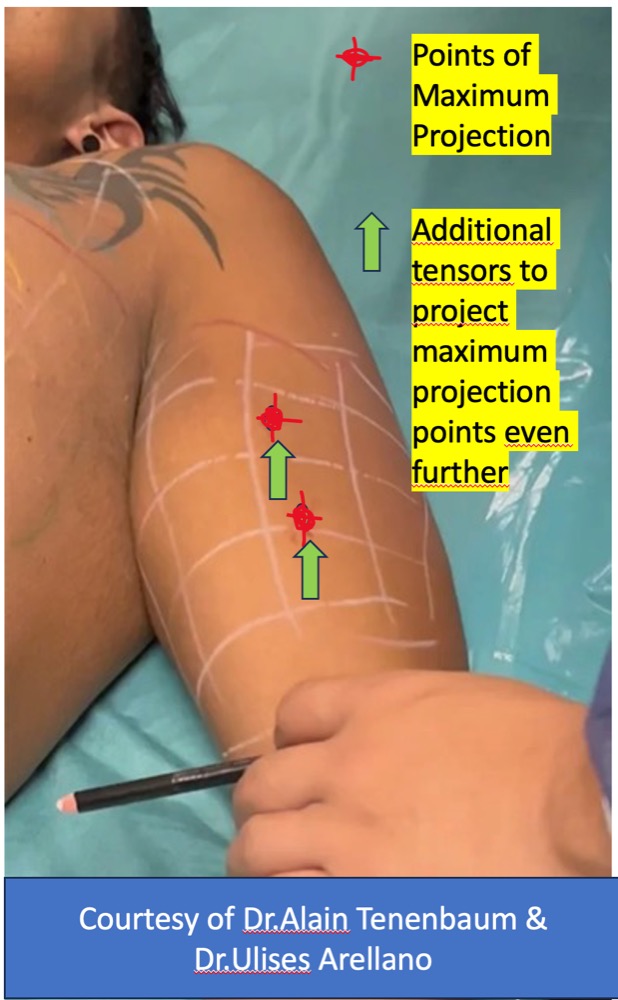 Step9-additional-tensors