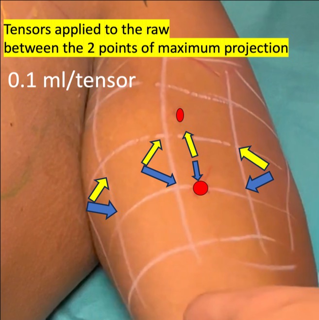 tensors-intermediate-row