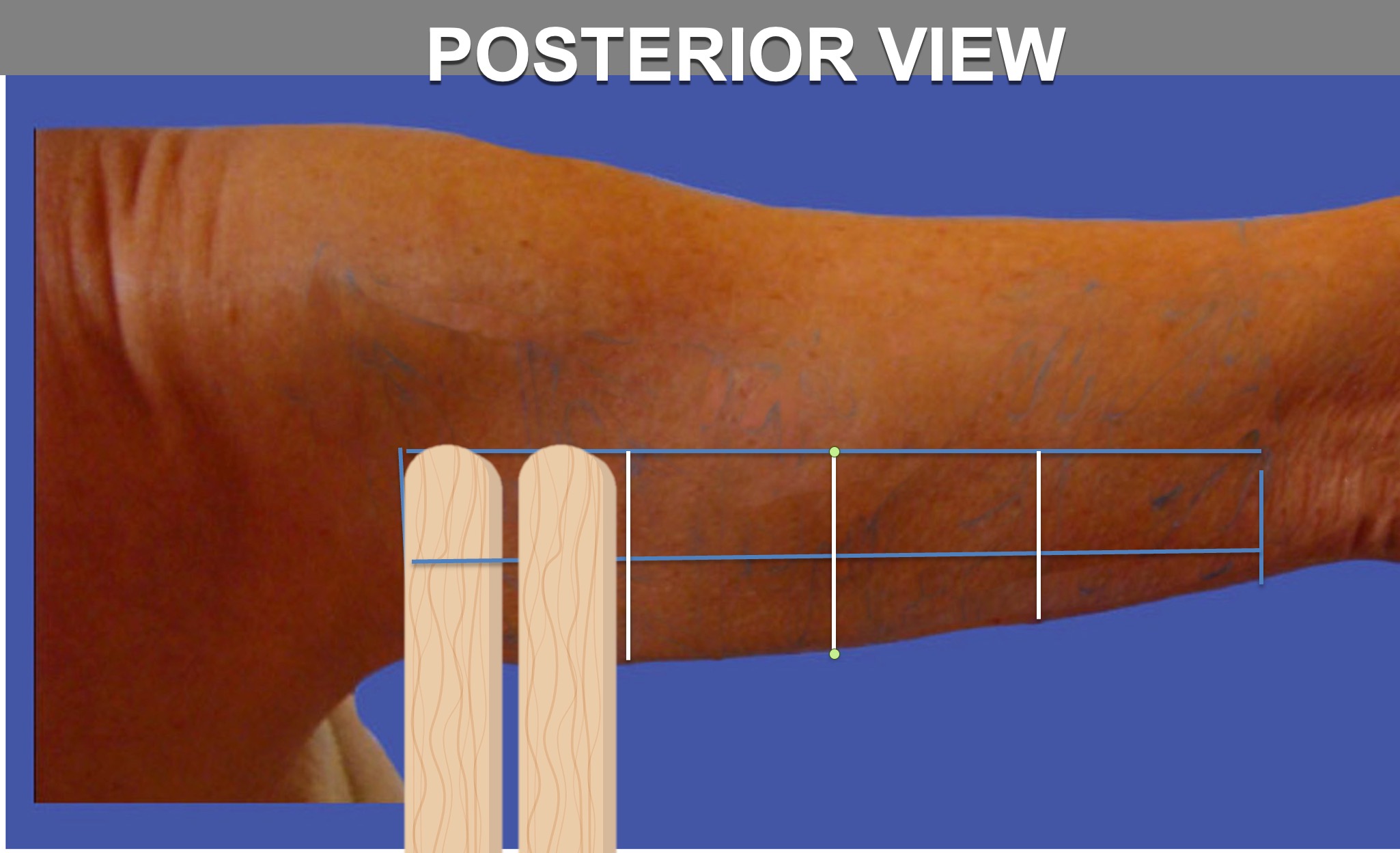 squares-division-4-2