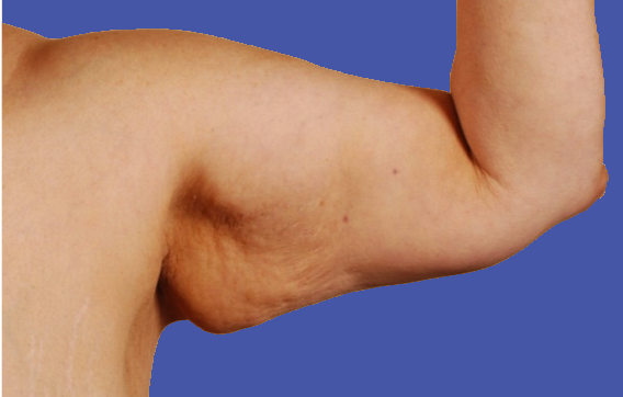 bingo-wings-definition