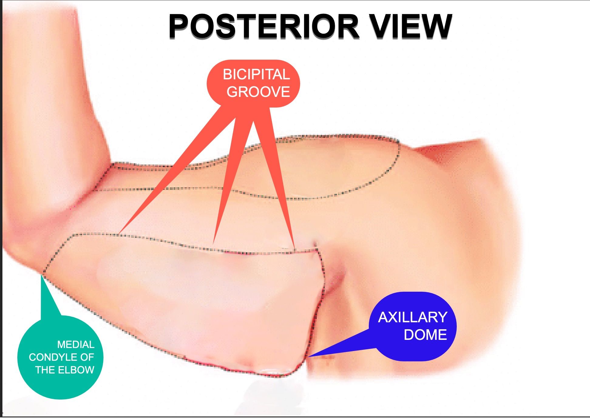 posterior-view-limits-bingo-wings