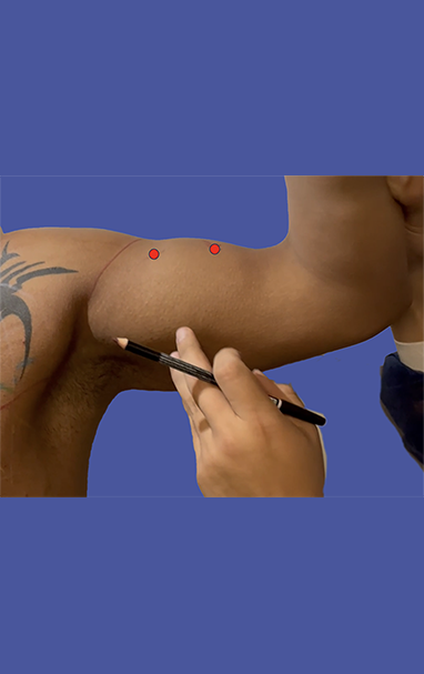 anterior-view-2 points-projection