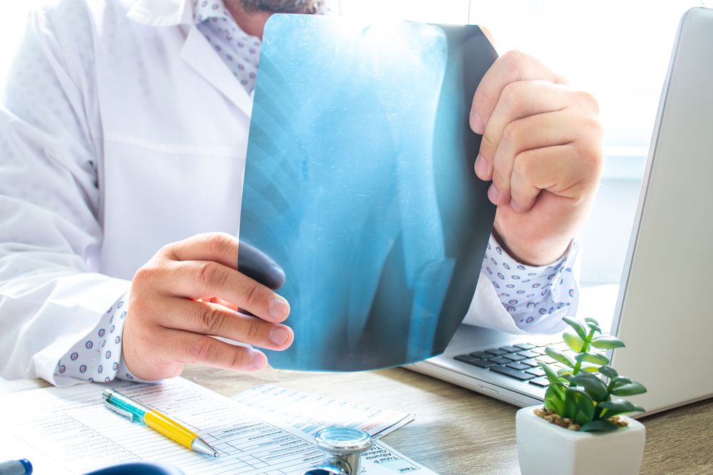 skeletal-abnormality-arm