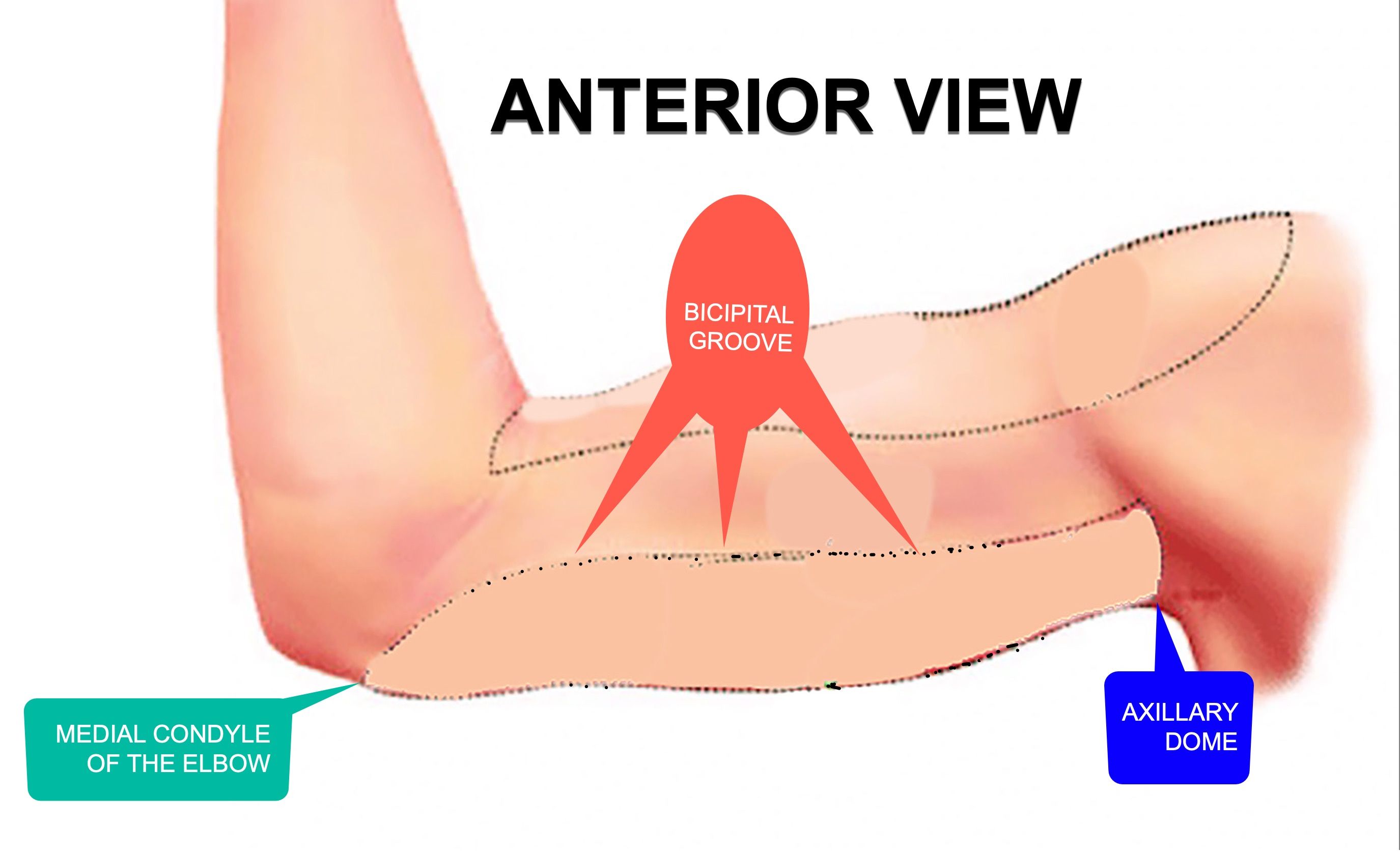 limits-anterior-bingo-wings.