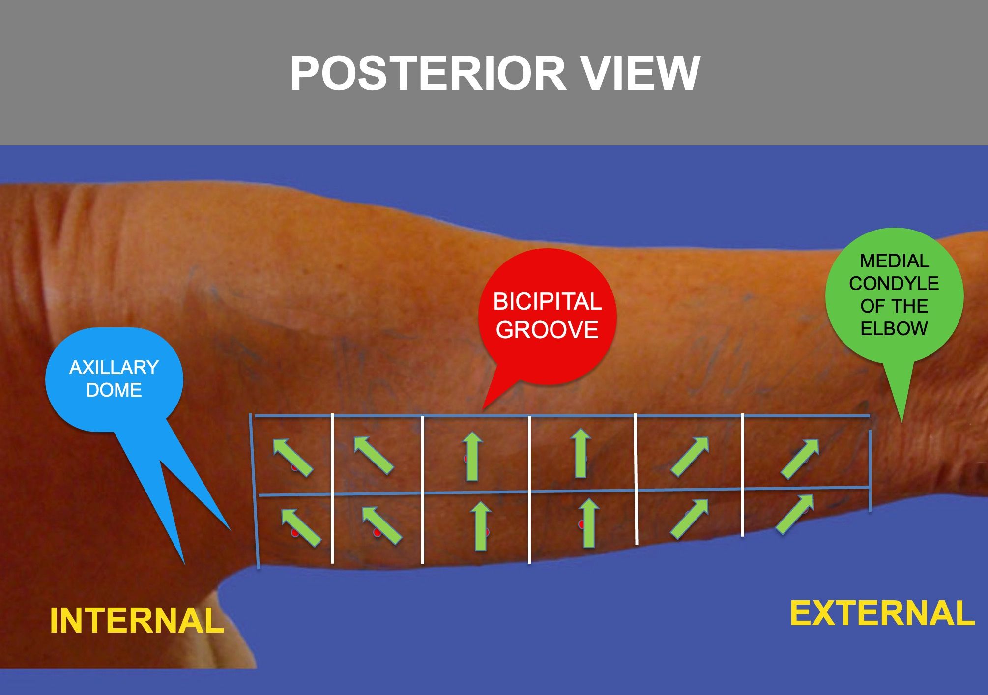 Step8-TENSORS-POSTERIOR-VIEW