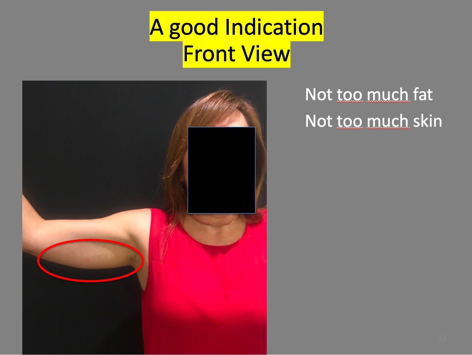 step1-photo-front-view