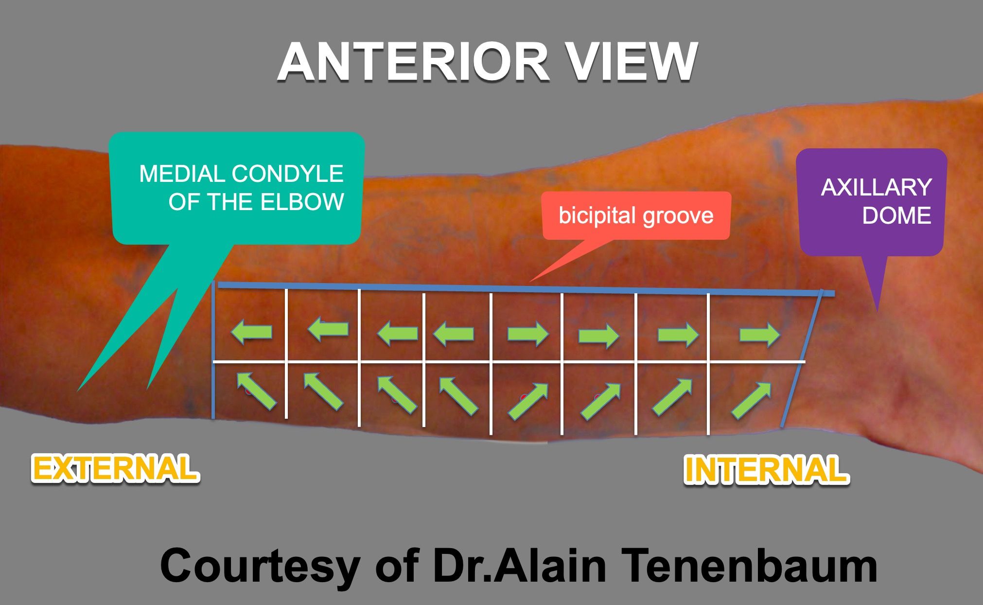 Step7.1-tensors-anterior